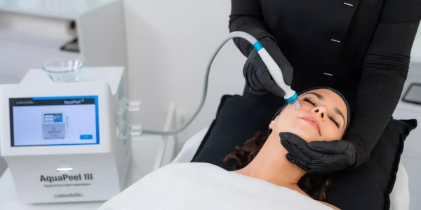 AQUAPEEL